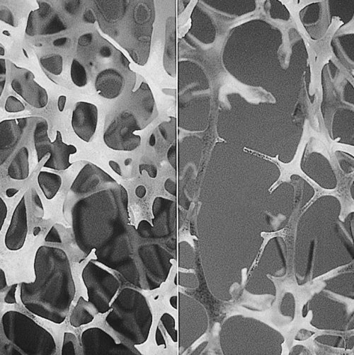 Bone_normal_and_degraded_micro_structure